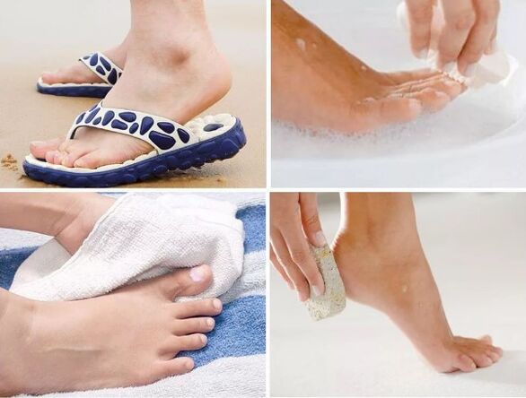 Prevention of fungus