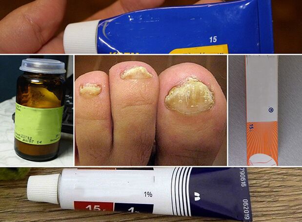 A general principle for the treatment of fungus