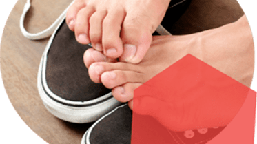 itchy foot skin, symptoms of fungal infection